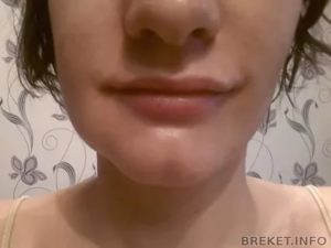 После удаления 8 ки