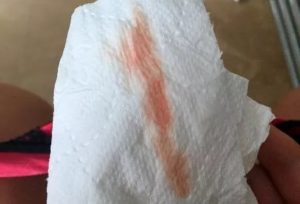 Месячные 2 дня шли и появилась потом мазня