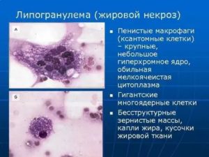 Бесструктурное вещество, макрофаги