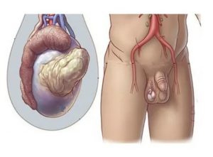 Шишка под яичком