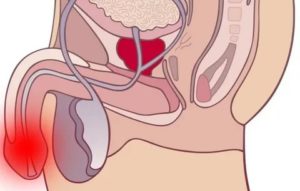 В чем причина пульсации в половом члене