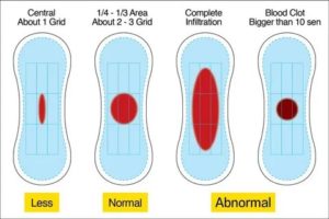 Обильные месячные после лишения девственности