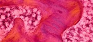 Тяжесть в желудке и синдром манной крупы