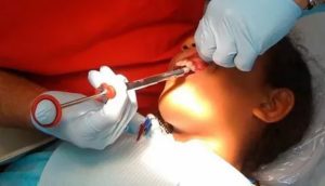 Рыбная кость уколола десну