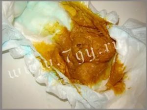 Жидкий стул полгода