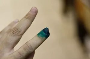 Отрезало половину подушечки пальца