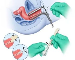 Может ли беременная отказаться от взятия мазков