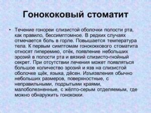 Гонорея во рту