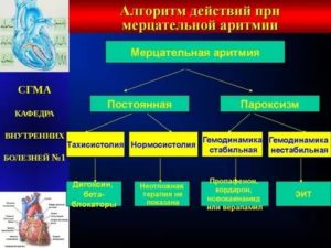 Сотагексал с кордароном при мерцательной аритмии