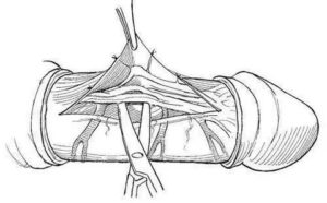 Хруст полового члена