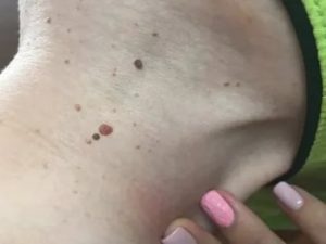 Очень мягкие родинки в паху