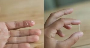 Белые выделения, но не молочница