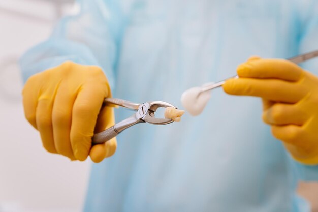 Удаление зуба мудрости иркутск Удаление зуба мудрости иркутск