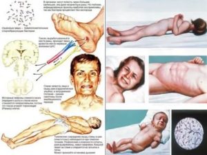 Риск заражения столбняком дома