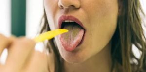 Тёмный налёт на языке ангина насморк