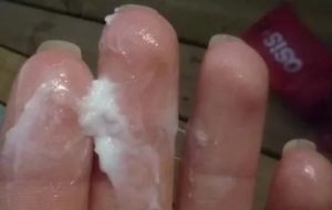 Белые выделения, но не молочница