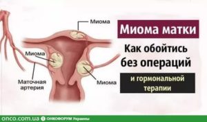 Субфебриллитет миома