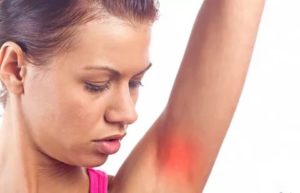 Гидраденит, фурункул или лимфоузел