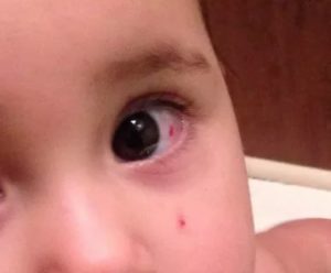 Кот поцарапал глазное яблоко