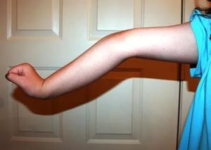 Руку выворачивает