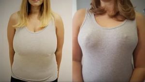 Резко уменьшилась грудь