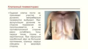 Стуки в грудной клетке