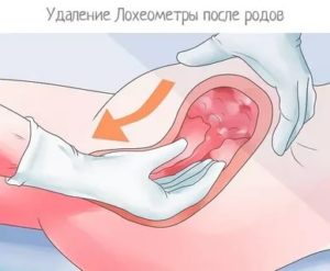 Первый секс после родов. Выделения