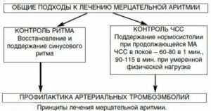 Сотагексал с кордароном при мерцательной аритмии
