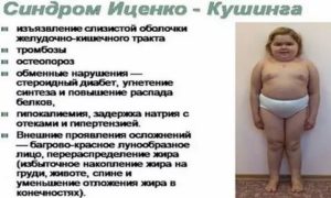 Синдром Иценко Кушинга