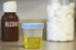 Цистит и запах