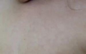 Сыпь под молочными железами, на шее, животе